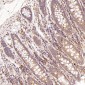 Anti-BNIP3 Rabbit Monoclonal Antibody